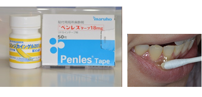 表面麻酔