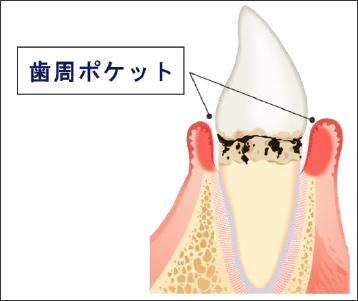 名前